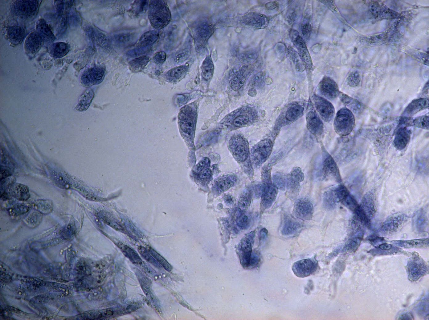 Biokompatible Hochleistungskeramik für Endoprothesen